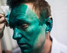 Навальный рассказал о состоянии ослепленного глаза