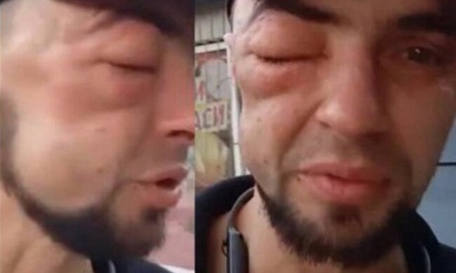 Побит военный. Фото: Twitter