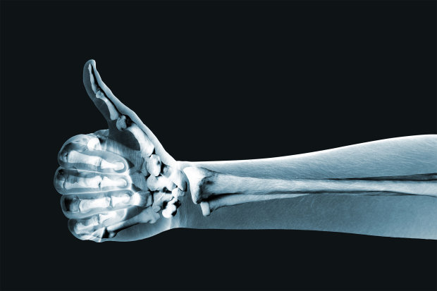 Отримай відповідь: як зміцнити кістки без спортивних вправ