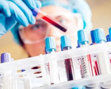 Кожен другий помирає від невиліковного вірусу і не знає про це