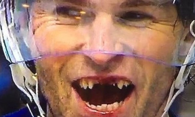 Знаменитий хокеїст попросив у Санта-Клауса нові зуби