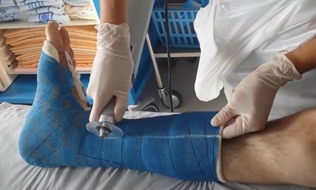 Українцям продають гіпс на руку-ногу, щоб "врятуватися" від повістки: "Аксесуар на вулицю"