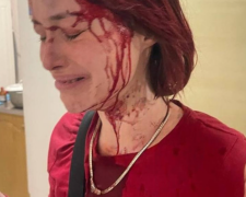 Девушка, избитая работником ТЦК. Фото: "Думская"