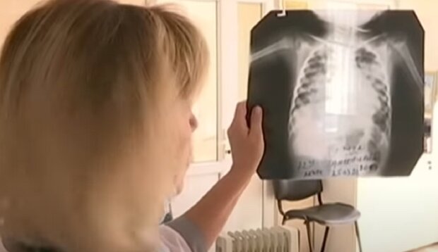 Дитина страждає від коронавірусу, кадр з репортажу Україна: YouTube