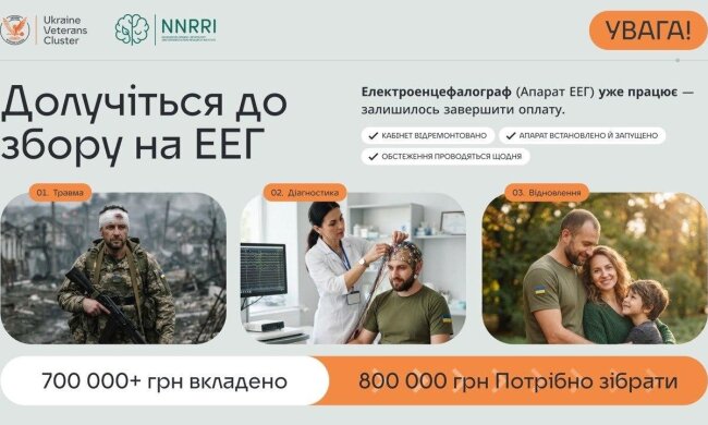 Мозок не кричить. Йому потрібен запис