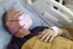 "Щасливчик року": чоловік в Індії заразився трьома смертельними недугами