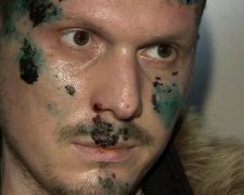 Покушение на Осмаева: врачи рассказали о состоянии его здоровья