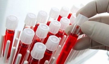 Аналіз крові визначить вірогідність  смерті людини