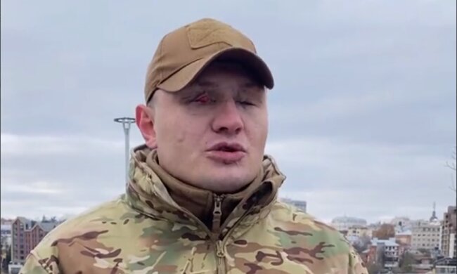 У гурті "Антитіла" хамсько відповіли пораненому захиснику на прохання: "З якої радості..."