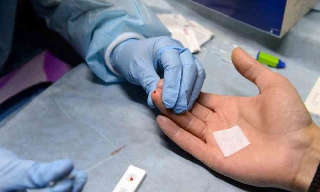 Украинцы лидируют в распространении ВИЧ: заражен почти каждый