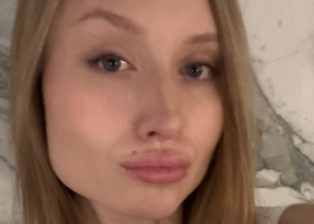 Девушка с неудачными "уколами красоты", фото из соцсетей