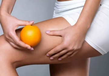 Целлюлит, изображение из свободных источников