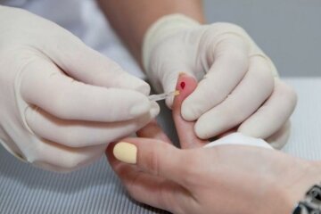 Новий тест допоможе виявити рак задовго до появи симптомів
