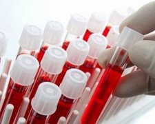 Аналіз крові визначить вірогідність  смерті людини