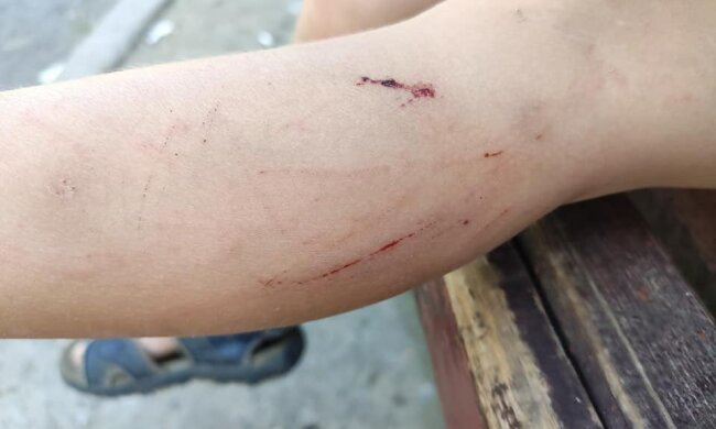 В центре Ужгорода ребенок провалился в яму на глазах у матери - "Нет слов…"