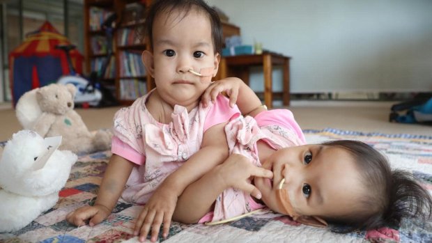 Одно сердце на двоих: индийская женщина подарила миру уникальных близнецов