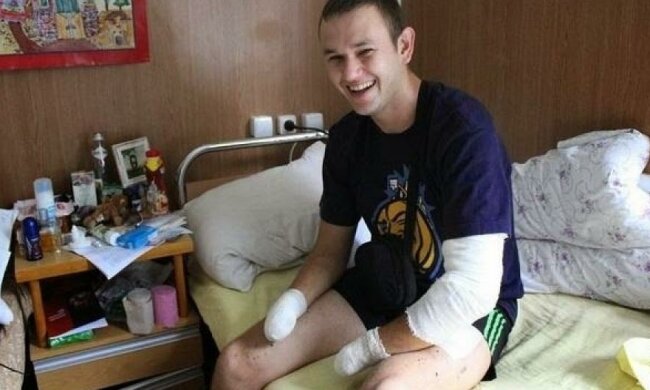 Боєць з ампутованими кистями рук став масажистом