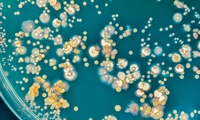 Небезпечні бактерії "населяють" людську шкіру, медики запропонували рішення