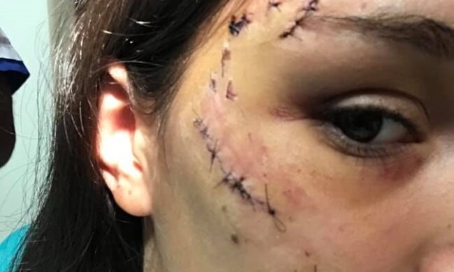 Укротительница собак пошагово разобрала нападение на девушку и дала советы, как уберечься от укусов