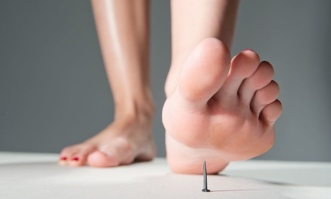 Не тільки іржавий цвях: як дійсно можна заразитися правцем