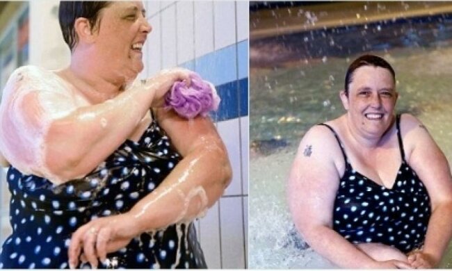 Гіпнотизер змусив британку помитися вперше за 30 років