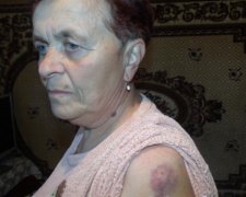 В Тернополе проститутка избила пенсионерку за замечание