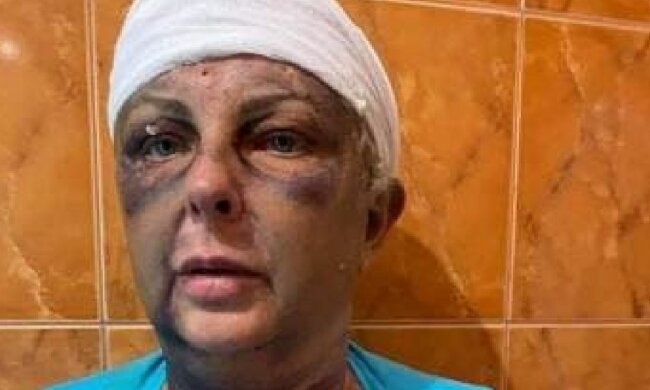 Ольга Волкова, фото: Telegram