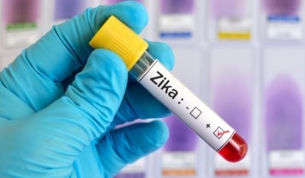Вчені знайшли ліки від вірусу Зіка в тілі людини