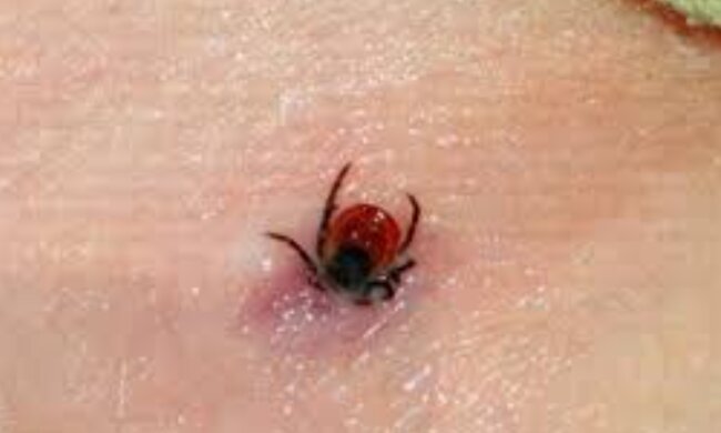 Клещ, скриншот: YouTube