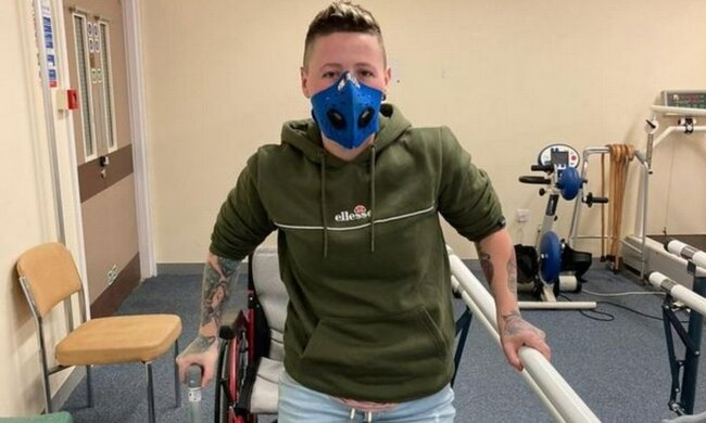 Ребекка Хамфріс, якій ампутували ногу