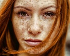Ці люди частіше страждають на рак шкіри