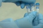Медики відмовилися лікувати хлопчика з коронавірусом, ошелешена мати розкрила правду: "Розпухла шия і болів живіт"