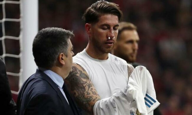 Капитан Реала избежал операции и будет играть в маске