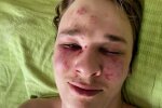 Парень пытался покончить с собой после задержания ТЦК / фото: скриншот Instagram