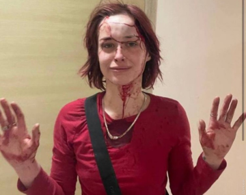 Дівчина, побита працівником ТЦК. Фото: "Думська"