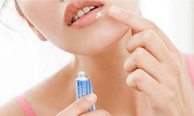 Дослідники знайшли спосіб перемогти герпес