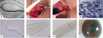 Домашня кішка заразила жінку 4 черв'яками / фото: BMC Ophthalmology