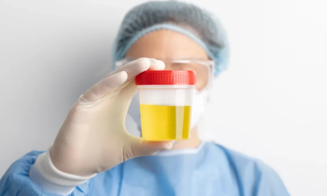 Моча в баночке / фото: Pixabay