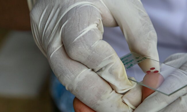 аналіз крові, фото Getty Images