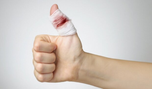 Как остановить кровотечение из мелкой раны