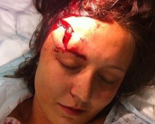В Червонограді майор поліції розбив жінці голову