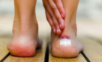 Мозолі, зображення з вільних джерел