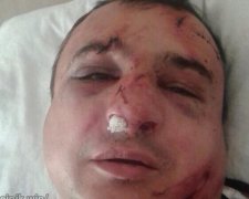 Жорстоко побили сепаратиста Клінчаєва, який підняв прапор РФ на будівлі ОДА (відео)