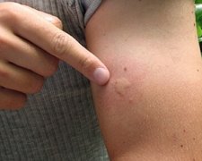 Всього за день вірусом Зіка заразилися 27 сінгапурців