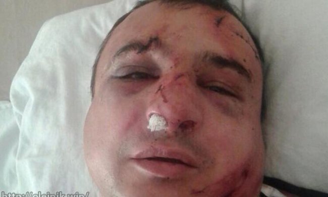 Жорстоко побили сепаратиста Клінчаєва, який підняв прапор РФ на будівлі ОДА (відео)