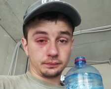 "Купити мінералки і втратити око": львів'янин травмувався, відкриваючи пляшку води