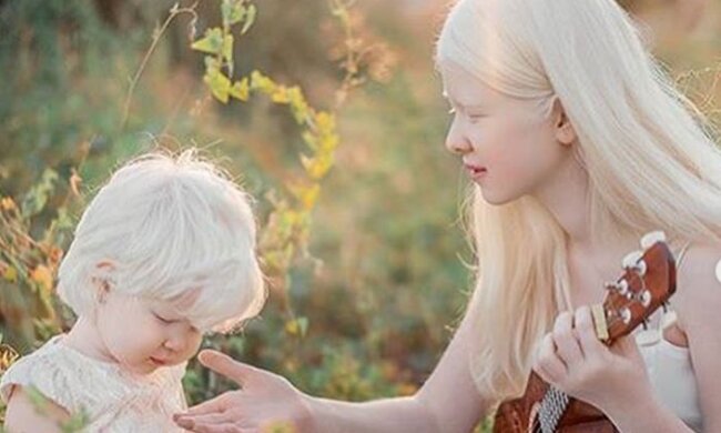 Очаровательные сестрички-альбиносы замиловали мир уникальной красотой: как фарфоровые куклы