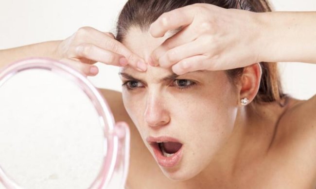 Треугольник смерти: чем грозит самостоятельное удаление прыщей