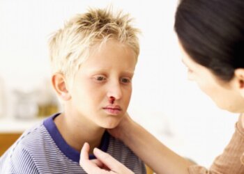 Носовое кровотечение: фото из свободных источников