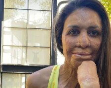 Instagram/Turia Pitt